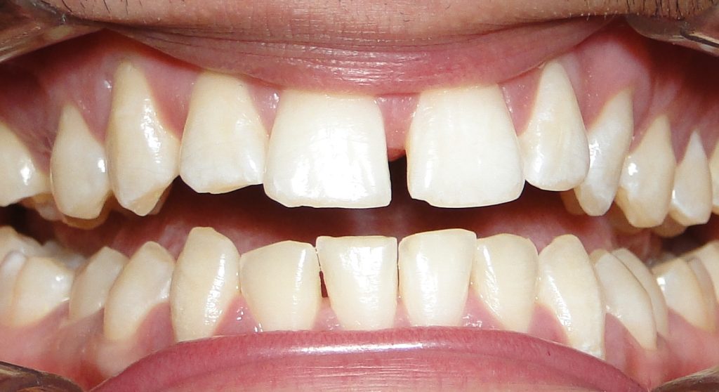 várias bocas em posições diferentes. com dentes, língua, sorriso