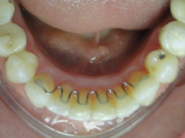 Várias bocas em diferentes posições. com dentes, língua, sorriso, raiva.