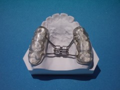 Dentes faltantes ou quebrados e Invisalign - Samanta Nigro