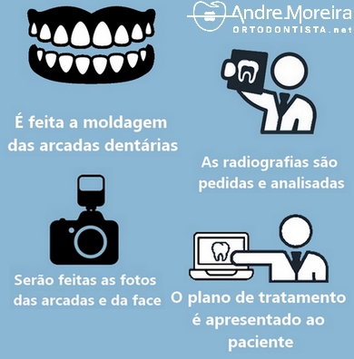 Tratamento com aparelho ortodôntico fixo - planejamento