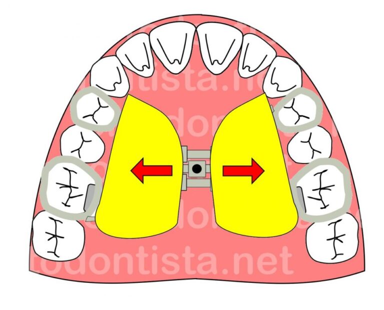 Disjuntor haas Expansores e disjuntores - foto 01