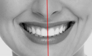 Linha média ortodontia
