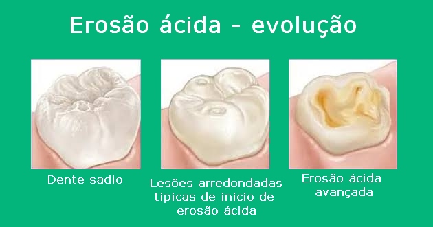 erosão ácida
