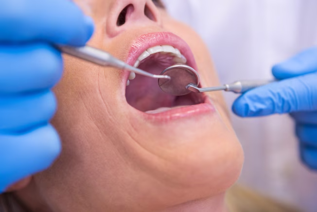 Tratamento de canal no rio de janeiro