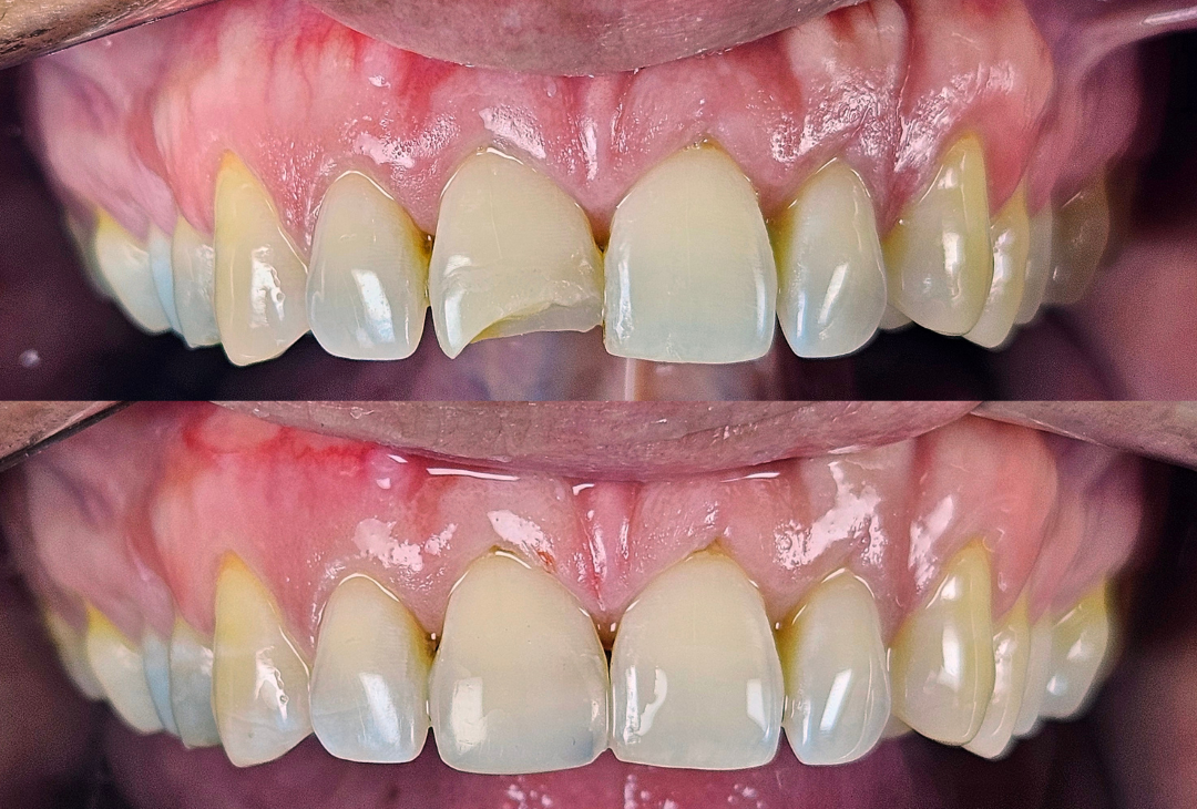 Post quadrado ideal feed Post quadrado ideal feed